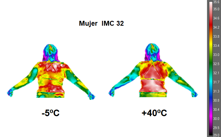 El proyecto FITME desarrollará un modelo integral para la evaluación integral de la obesidad.